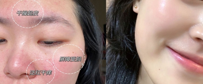 雅诗兰黛 公认好用5款零差评孕妇水乳,雅诗兰黛干皮救星、娇韵诗去黄提亮