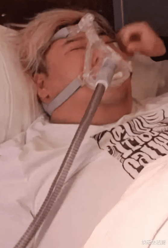 运动 曝胖猴仔减肥出事，被下3次病危通知，用生命做吃播，该停了