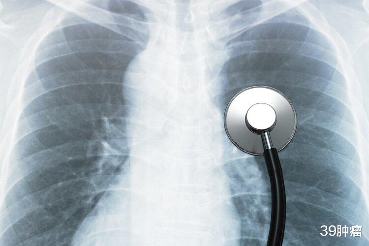 新冠病毒|感染新冠病毒后，突发肺结节的人越来越多，对身体有什么影响？