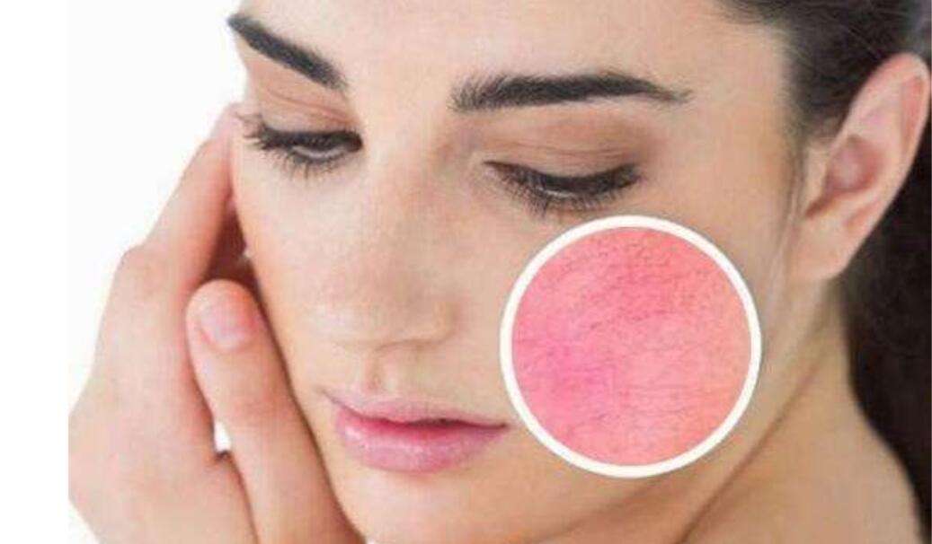 面膜 皮肤经常出现问题会让你不自信吗?收好这份冬季护肤指南