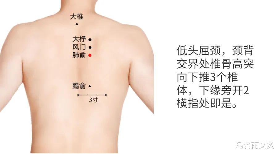 更年期|痰湿：吃甜食导致的多痰，肥胖和肺部结节，哪个穴位化痰最好用？