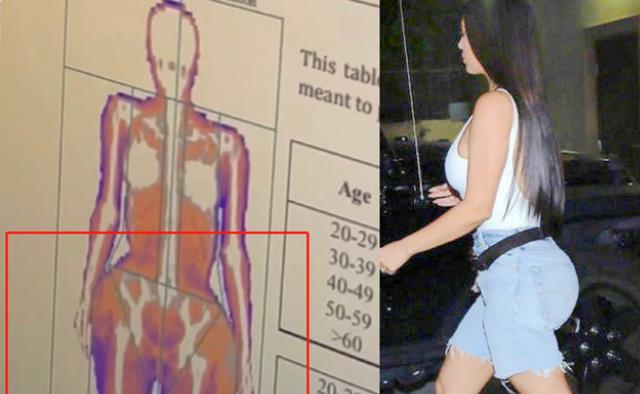 金·卡戴珊|畸形审美!金卡戴珊晒体检报告,臀腰比例夸张,如今瘦到仅104斤