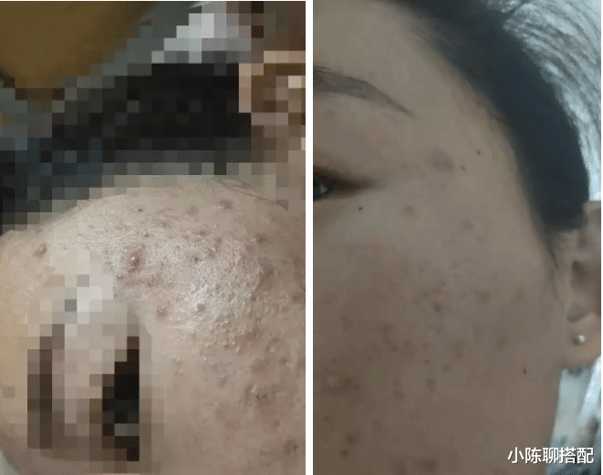 保湿 这7款因包装被严重低估的老国货，很丑却很好用，太可惜