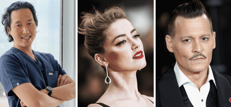 约翰尼·德普|德普与前妻是否动过脸？网红专家：她动过鼻子和嘴唇