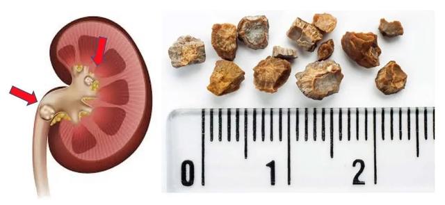 地球变暖可能给我们带来的12种影响