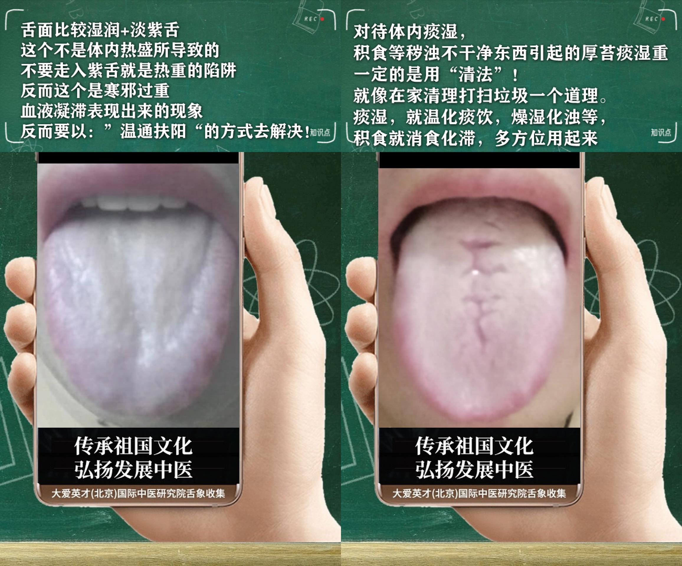 萎缩性胃炎|中医分析:心烦气短,胸闷、咳嗽,好好坏坏非常崩溃