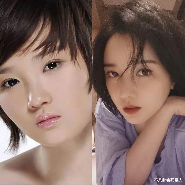 陈哲远|双下巴、颧骨凸出、面中凹陷，5位明星“换头”成功，缺陷也太明显