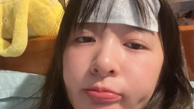 徐娇|徐娇自曝确诊“炫饭株”：一天吃5顿仍被饿醒，焦虑导致失眠