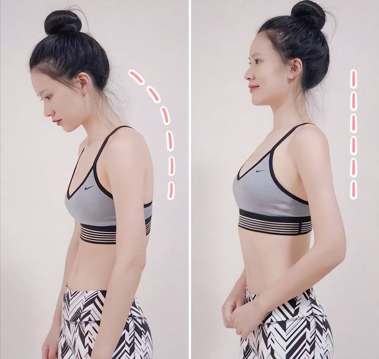 防晒 尴尬30多岁被误认成奶奶，长相和然打扮显老怎么逆袭变美？