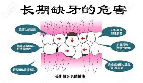 立秋|长期缺少一颗牙会带来什么影响？