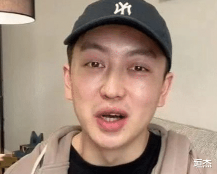 整容|网红金大威：哭诉整容失败史，小鲜肉变沧桑大叔，到底是谁害了他