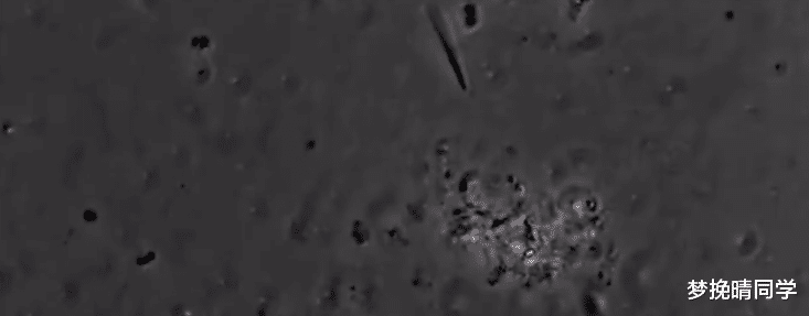 情侣|将人的口水放大4000倍，看完一阵恶寒，为何情侣接吻时不觉得恶心