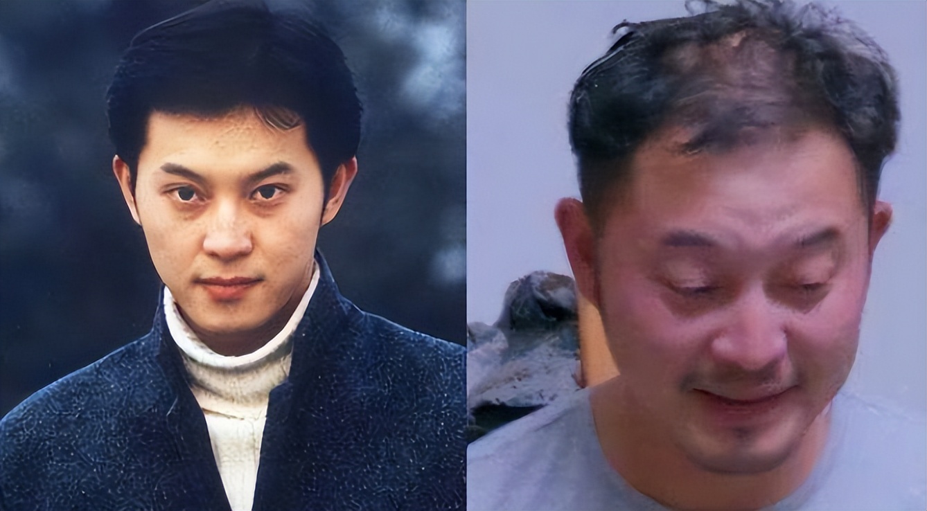 陈冠希|有种毁容叫人到中年！这十个男星曾经个个帅炸天，现在头顶变秃秃