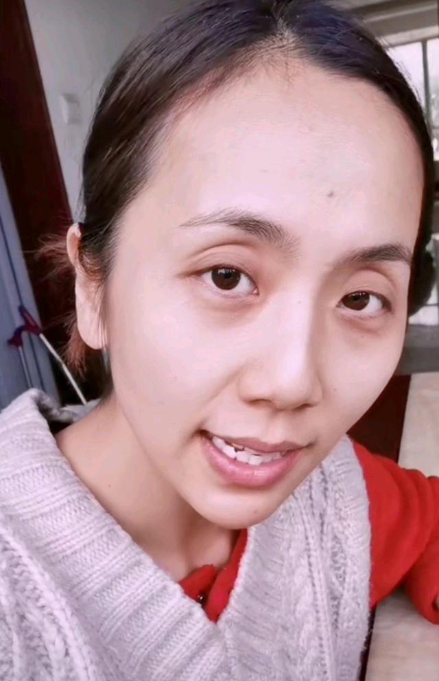 植物人|37岁女网红照顾植物人男友四年，没一句怨言，自愿为他挣钱养家