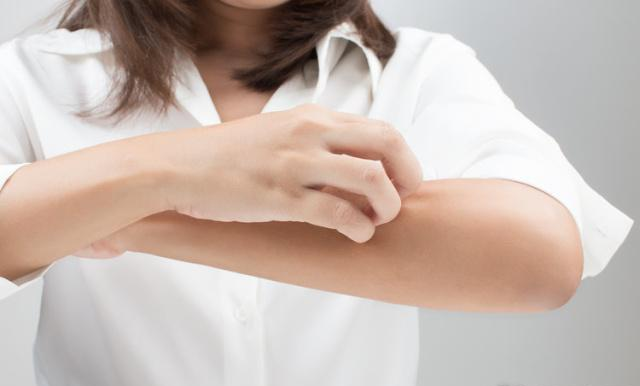 医生|经常皮肤瘙痒，请对症下药！3个解决方法记好了