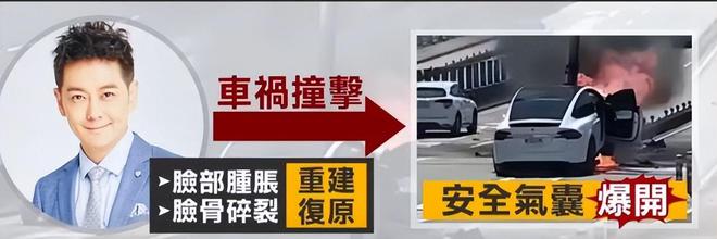 林志颖|林志颖的最新近况：未进行面部手术