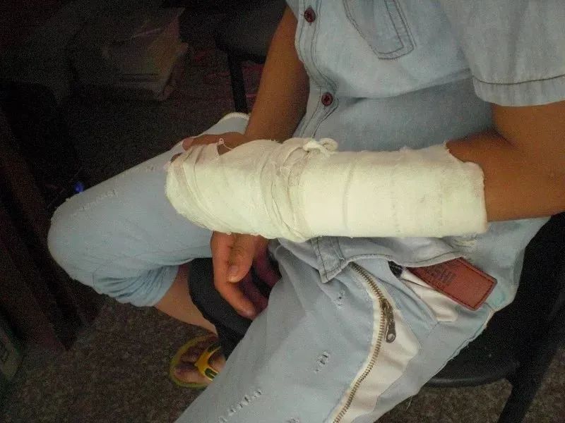 电池|一声巨响,手机炸了,儿女双亡:用手机别犯4个错,后悔都来不及。