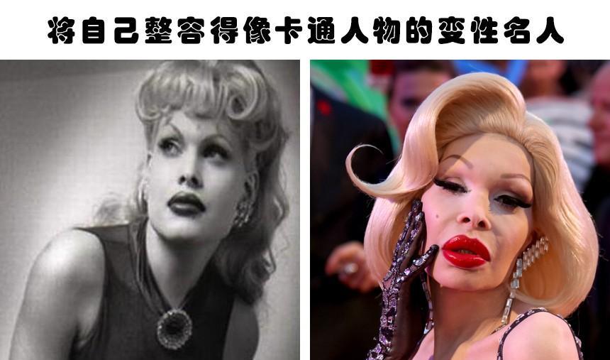 整容|整容失败的代价：据说因为整容而毁掉了自己容貌的6个人