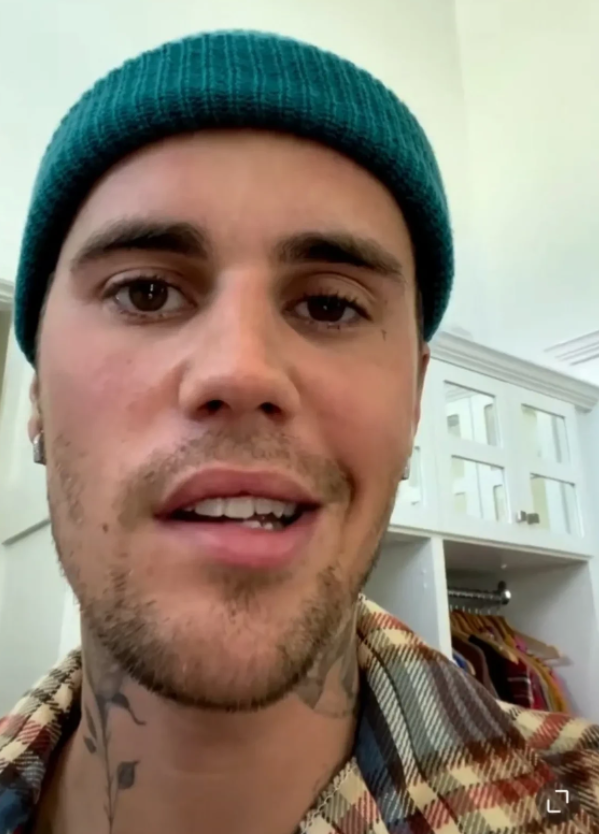 贾斯汀·比伯|比伯患上面瘫,右边脸无法动弹,眼皮无法眨动,宣布推迟世界巡演