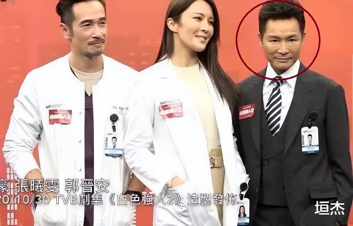 男神|脸部变形、发腮油腻、整容成瘾,细数8位男神的颜值暴跌之路