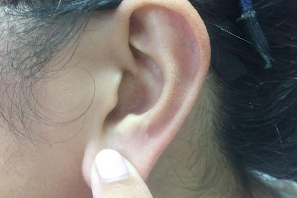 长寿|大眼睛,大耳垂是长寿的象征?直言:若有这些特征,你是长寿体质