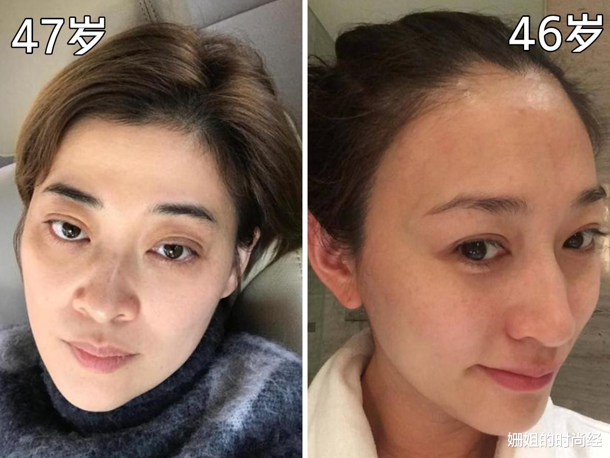 医生 眼霜“抹”与“不抹”，对比太明显！建议选对不选贵，这几款刚好