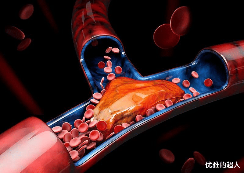 心脏|血管好不好,摸摸脚背就知道了