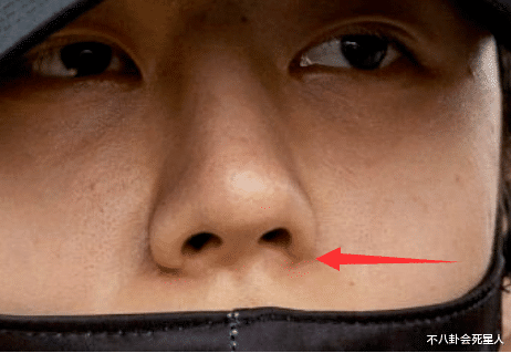 陈亚男|果然露馅了!凹陷、鼻梁中断,14位明星暴露动脸痕迹,看得心惊!