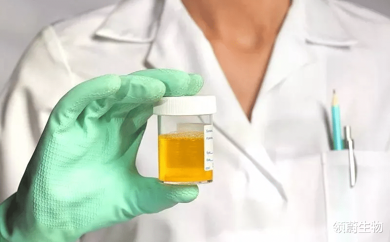 肾病|干细胞移植技术在延缓肾纤维化方面具有临床应用价值