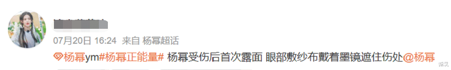 杨幂录节目受伤？五官位置里权值第一的是？