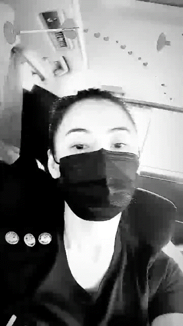 张柏芝|张柏芝被3岁小儿子抓伤脸部，伤口较长且深像刀疤一样遮都遮不住