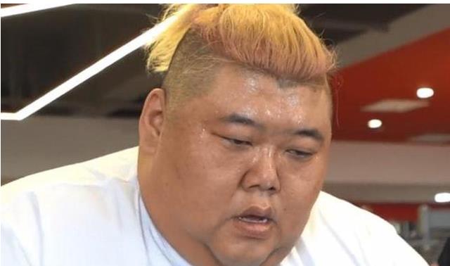 运动减肥 600斤网红胖猴仔选择运动减肥，体检单曝光，双腿青黑似穿秋裤