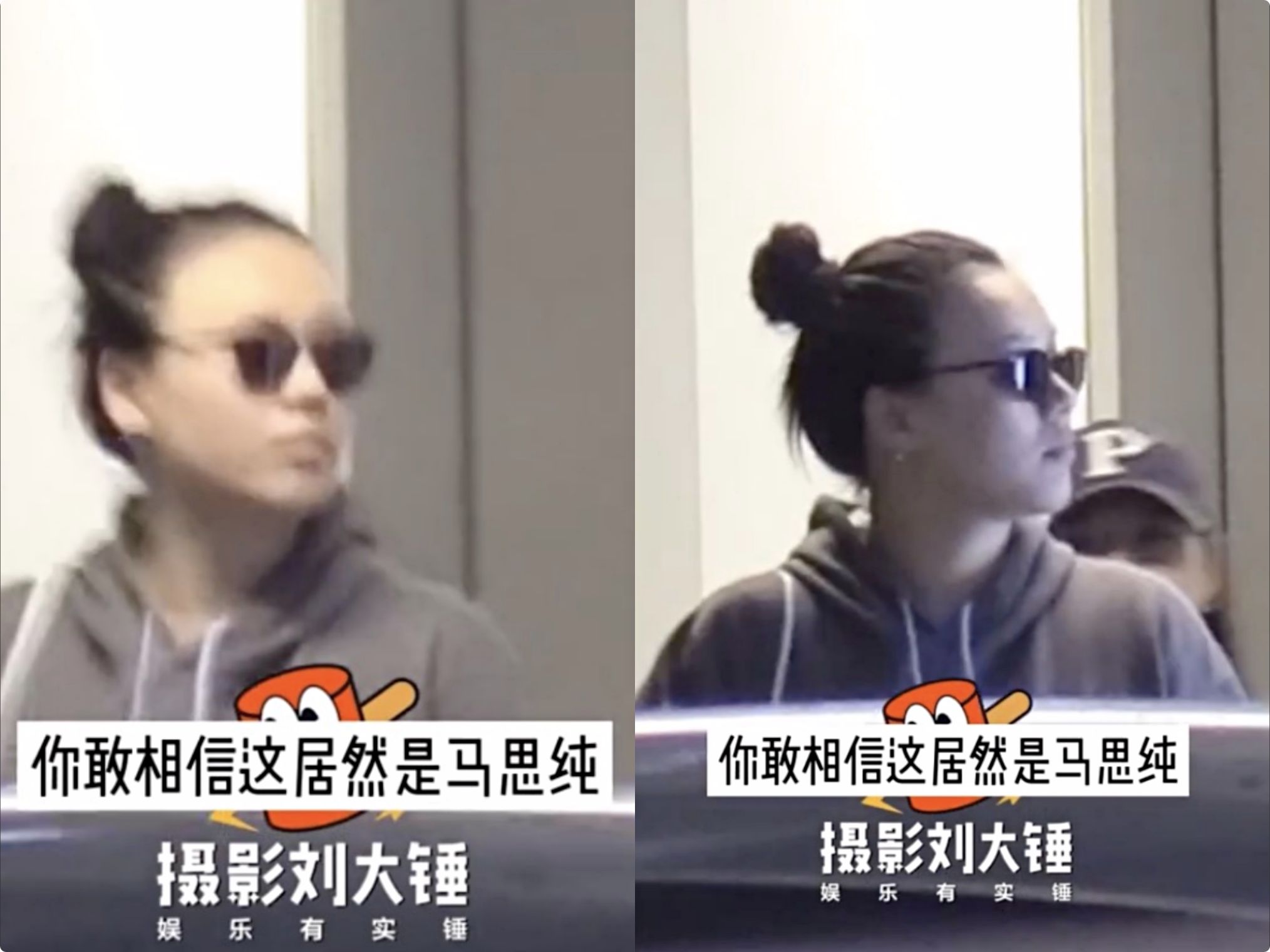 马思纯 马思纯和妈妈一同外出，扎丸子头发际线上移，被网友质疑产后脱发