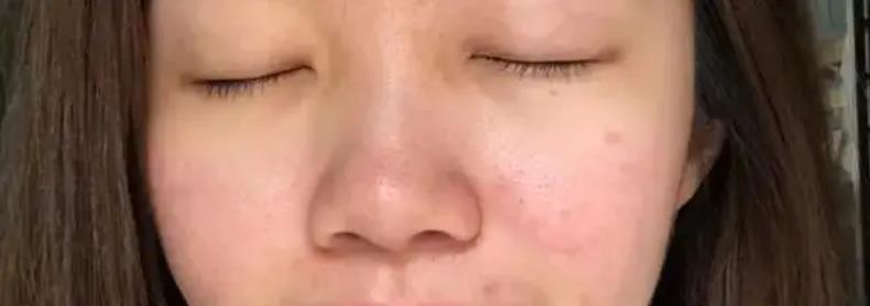 夏天脸上容易出油怎么办？分享4个护肤技巧，让你和大油田说拜拜