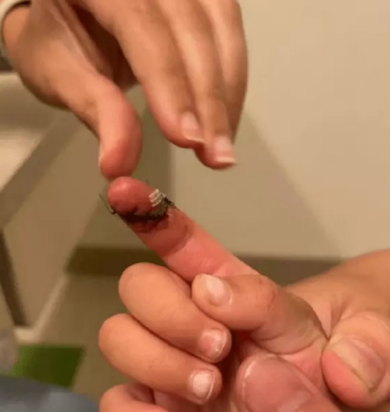 郑爽|郑爽虐童疑被实锤!孩子身上多处伤痕,郑爸力争直言母子关系亲密