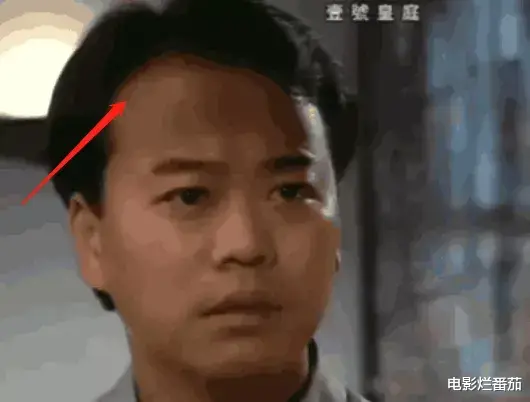 发际线|“秃顶”危机的10大男神，有人29岁发际线堪忧，有人常年戴假发套