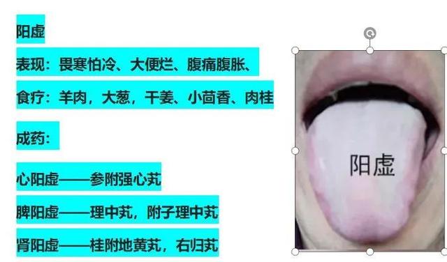 |气虚,血虚,阳虚,阴虚的调理