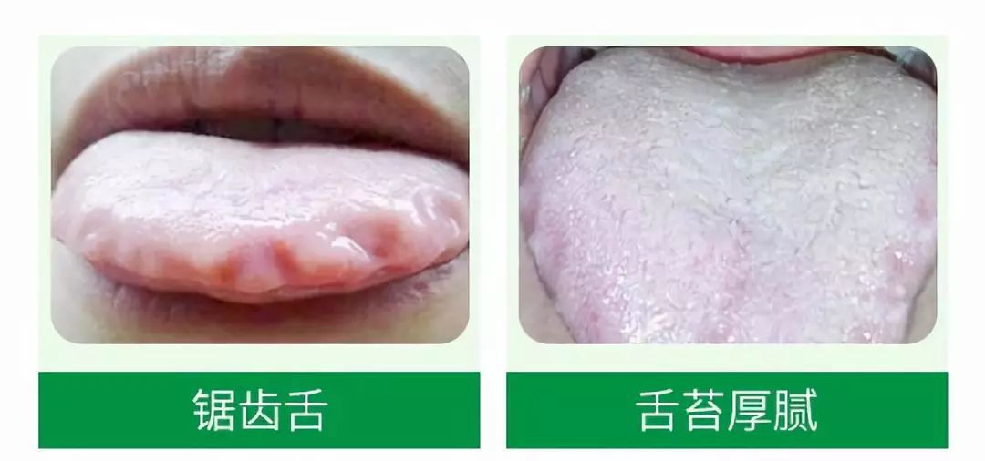 |痰多湿气盛、惊悸不寐?送你一方,切断生痰之源,灭掉生痰之本