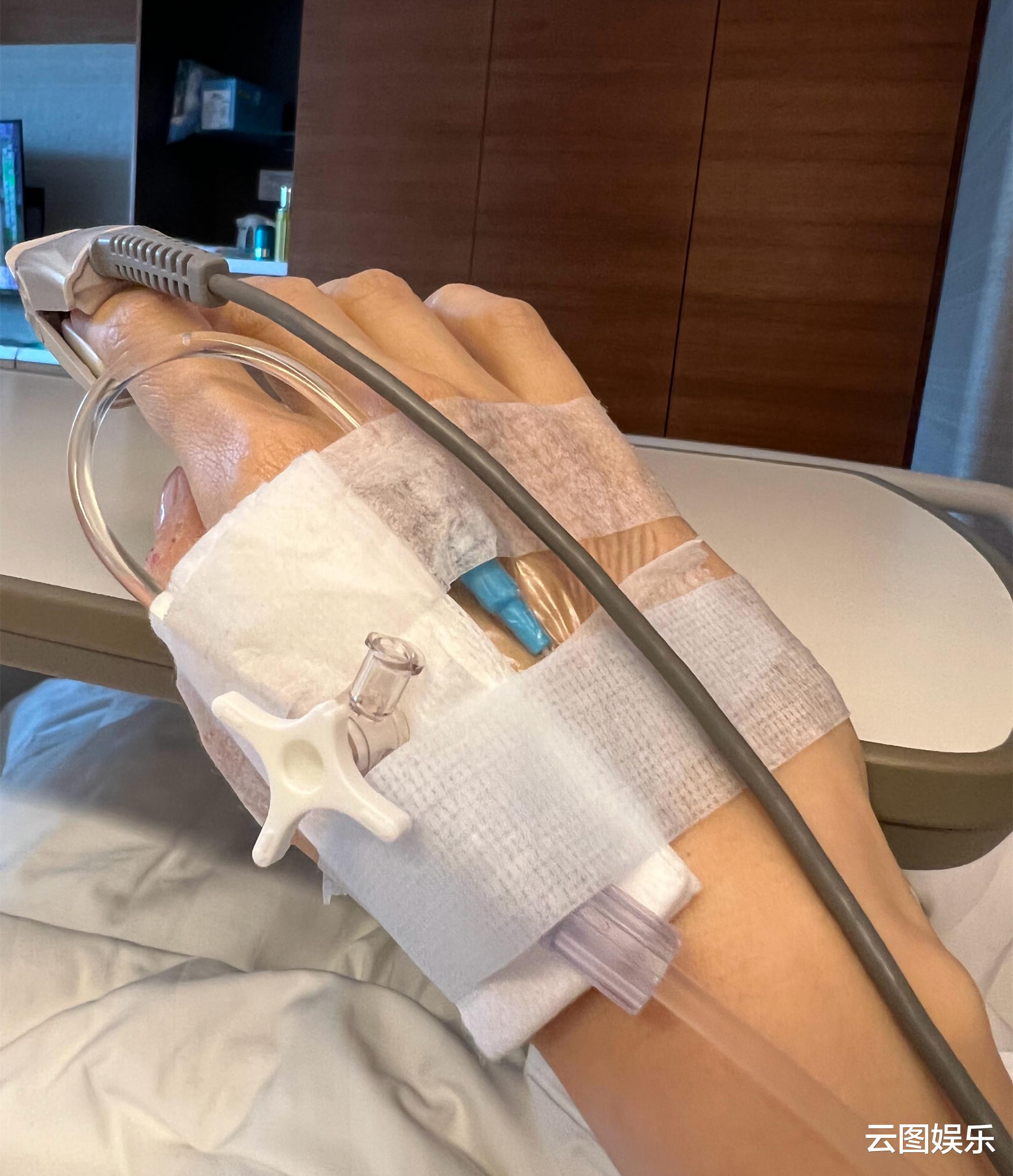 李嘉欣|51岁李嘉欣重病住进加护病房!戴鼻氧管一脸憔悴,自曝刚捡回一命