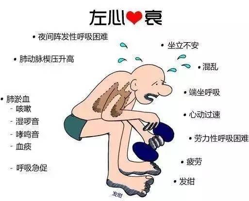 心力衰竭|治心衰有什么好方法吗？心脑血管吴欣芳主任回答