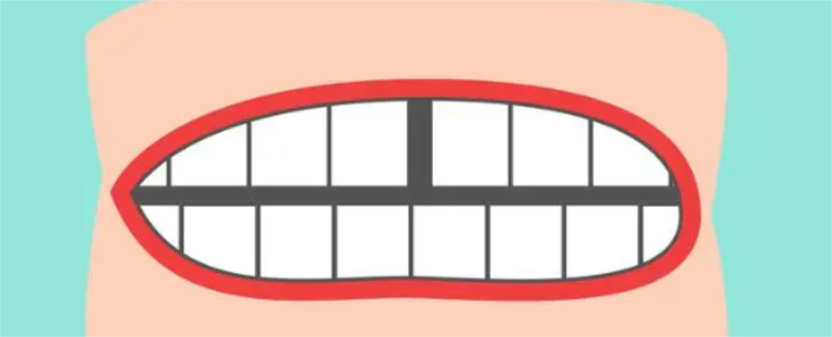 艾灸|门牙有缝怎么办？如何解决？