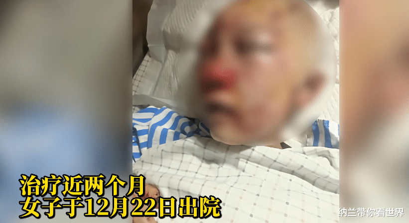 厕所被殴打女子右眼视力只有0.04,复明希望很小,至今未收到道歉