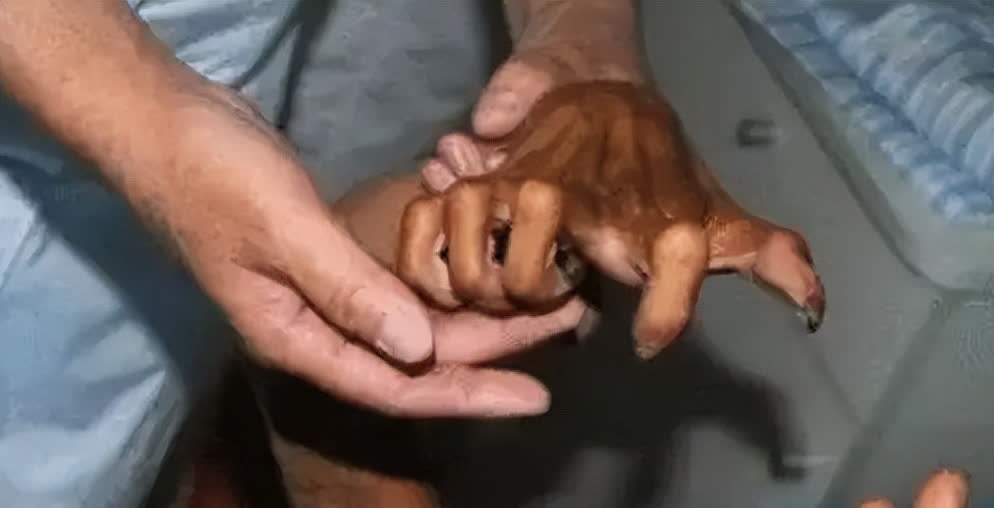 案例:男子山洞与世隔绝20年,身体兽化,手指和撕咬力比野兽还强!