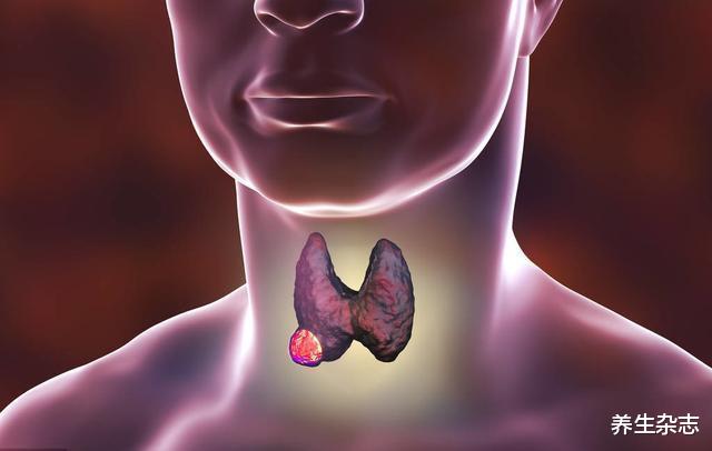 |转告父母：厨房3种“调料”，或是甲状腺结节“诱发剂”，趁早扔