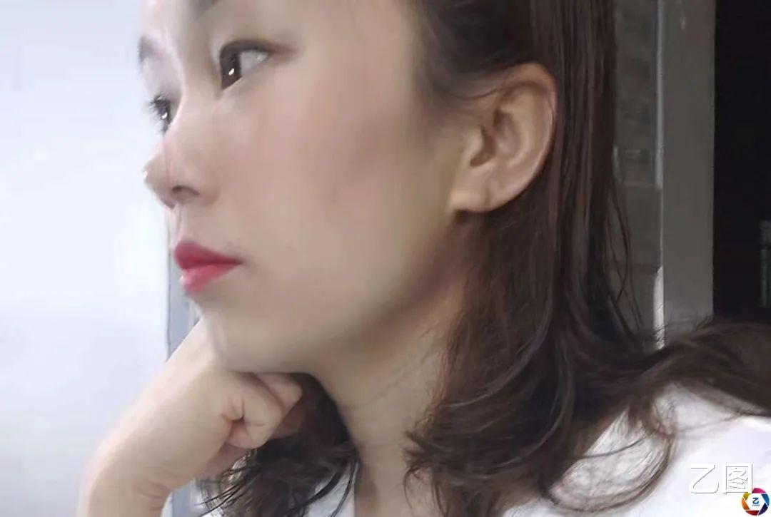 打工妹被女同事泼香蕉水点燃毁容,漂亮的模样如今成痛苦的记忆