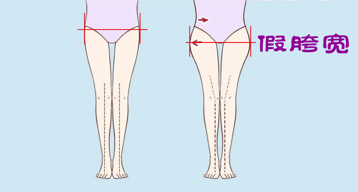 假胯宽|「假胯宽」怎么回事?正确的训练应该怎么做呢?2个动作搞定