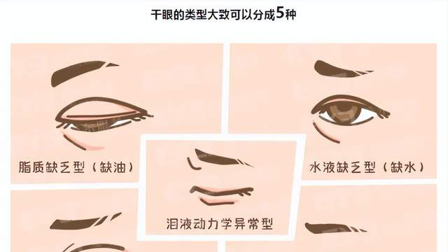 每天关灯玩手机会得干眼吗？