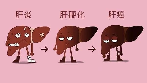 长寿|为什么肝癌总是在晚期才被发现?哪些症状可能是肝癌?