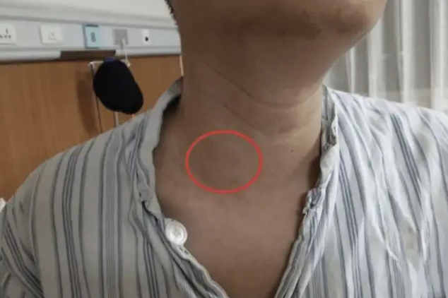 医生|?吃一口堪比吃“胶水”？医生提醒：街边“1种面”，隐含高科技，尽量少吃