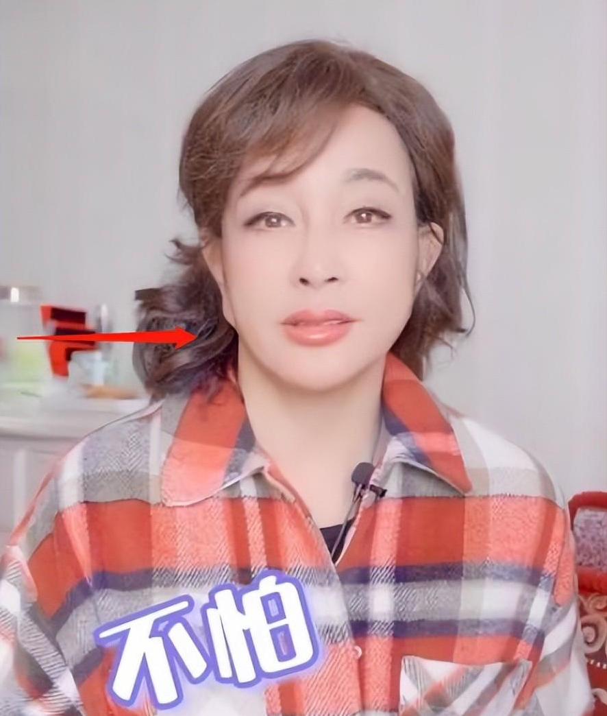 整容|在当奶奶的年纪整容，如今脸垮得没眼看，这些女星肠都悔青了吧